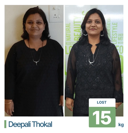 Before and after weight loss results for a client of Pune-based nutritionist Client 03