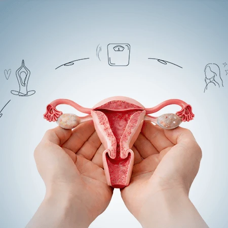 PCOD dietitian supporting hormonal balance and PCOS nutrition management