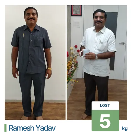 Weight Loss Treatment in Pune Client Result 2